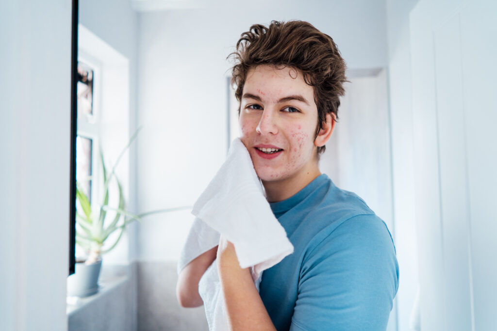 Jovem homem, cuidando da pele para combater a acne.